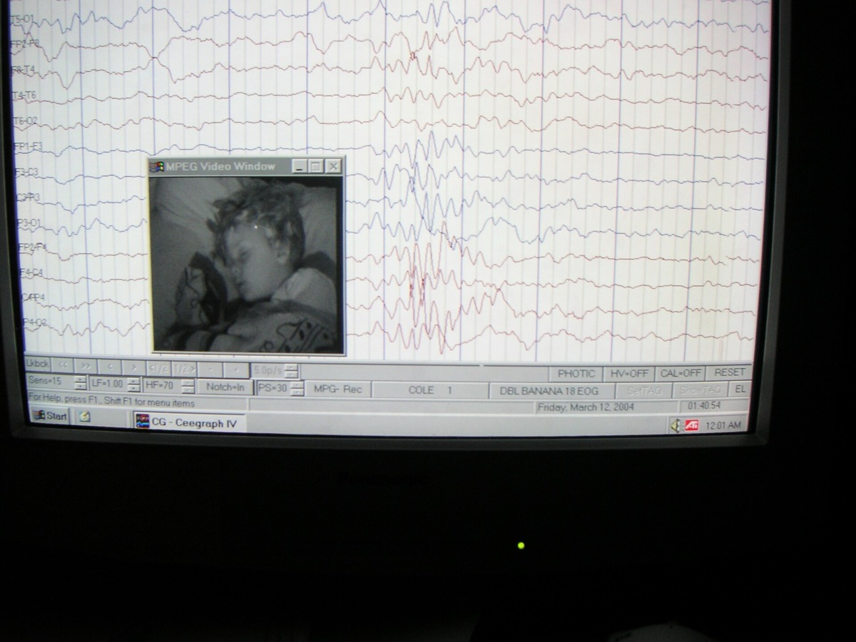 מסך מחשב מציג תרשים EEG, ובו חלונית עם אדם ישן.